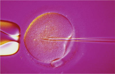 egg donation